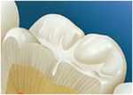 gum disease